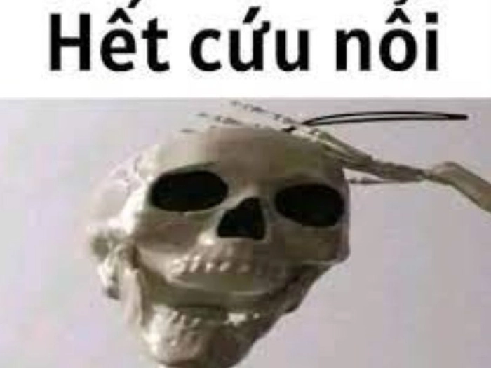 Loạt hình meme hết cứu bá đạo